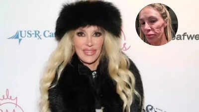  ‘I’ve had them for almost 20 years’