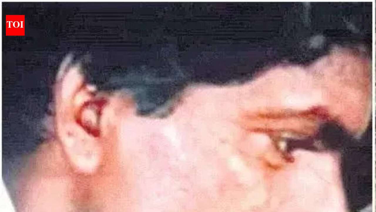 Devji’s surrender weakens Maoist core, pressure mounts in Bastar