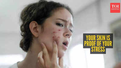 Is stress showing up on your skin before you even notice it?