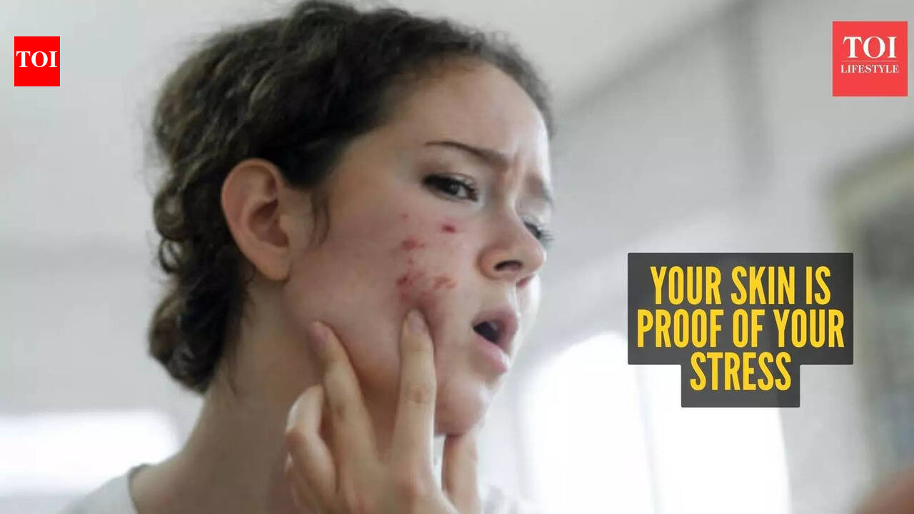 Is stress showing up on your skin before you even notice it?