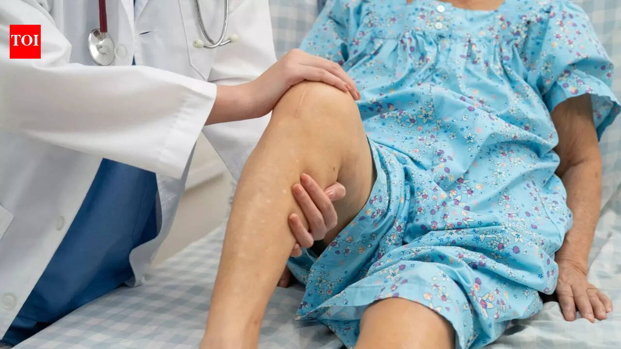 128-kg patient walks again after rare bilateral partial knee replacement in Mumbai