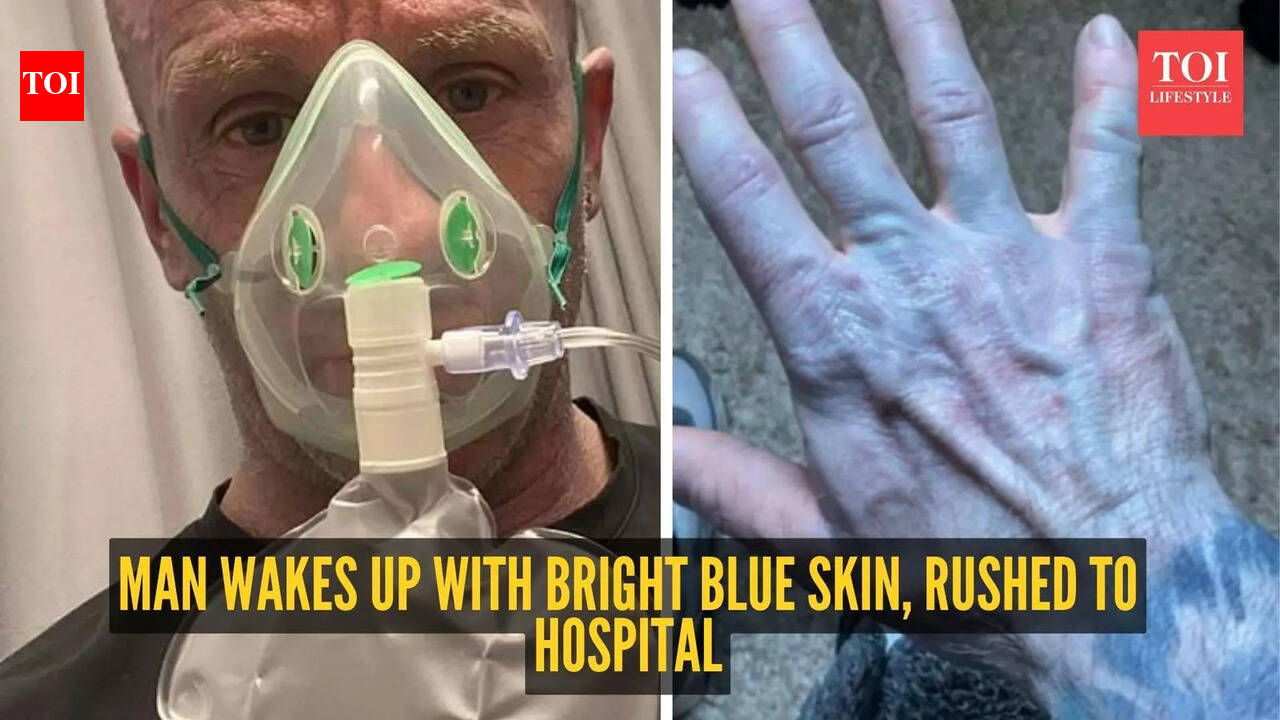 Man wakes up with bright blue skin, rushed to hospital; unexpected reason revealed later