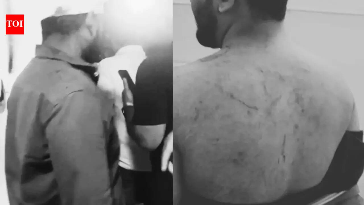 'Arrived on 100 bikes': 150 attack 14 men from Kondhwa during Iftar near Pune’s Askarwadi