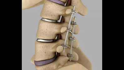 Titanium orthopaedic supply could become a casualty of Gulf crisis