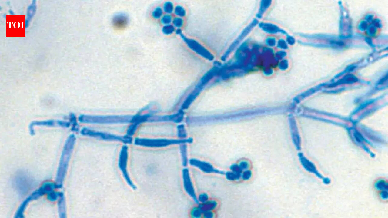 How to use Trichoderma to protect home plants from root diseases and promote better growth | – The Times of India