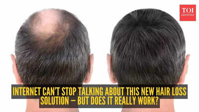 New hair loss cure? This ‘triple-threat’ treatment is taking the internet by storm