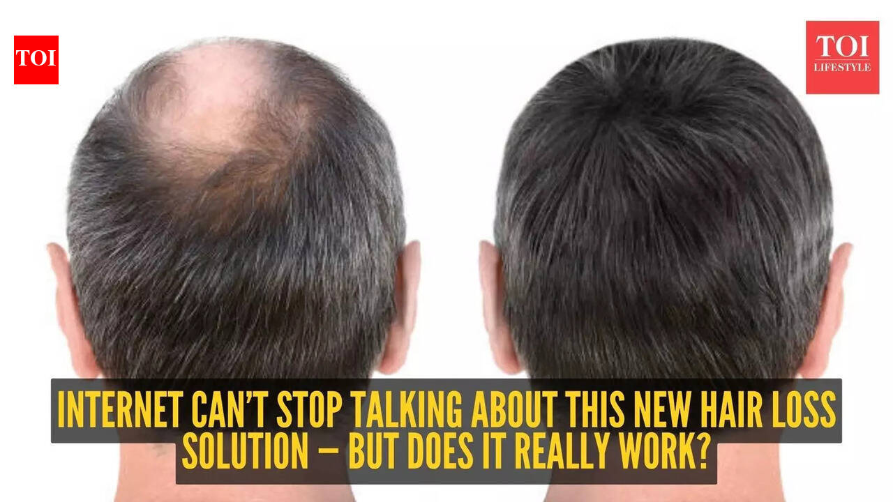 New hair loss cure? This ‘triple-threat’ treatment is taking the internet by storm