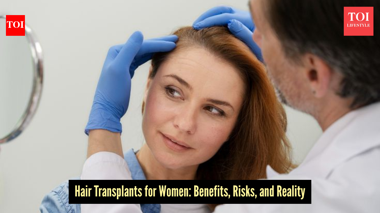 Can women get hair transplants? Here’s the truth