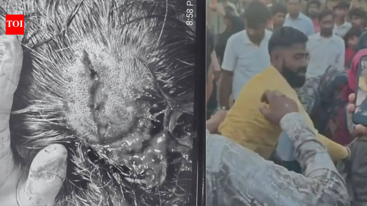 Attempt to save injured dog turns violent in Faridabad; rescuer critical, undergoes emergency surgery