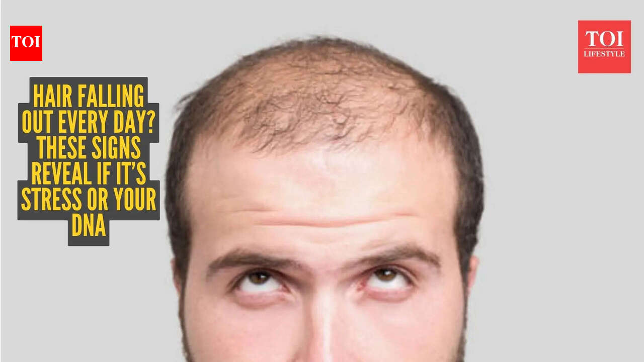 तनाव या आनुवंशिकी? आपके बाल झड़ने का असली कारण आया सामने!