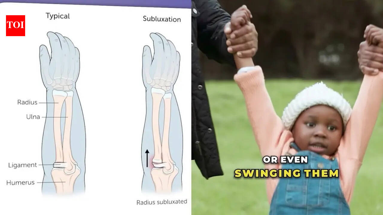 Doctor explains ‘nursemaid’s elbow’ in viral reel; parents urged to avoid pulling kids’ arms