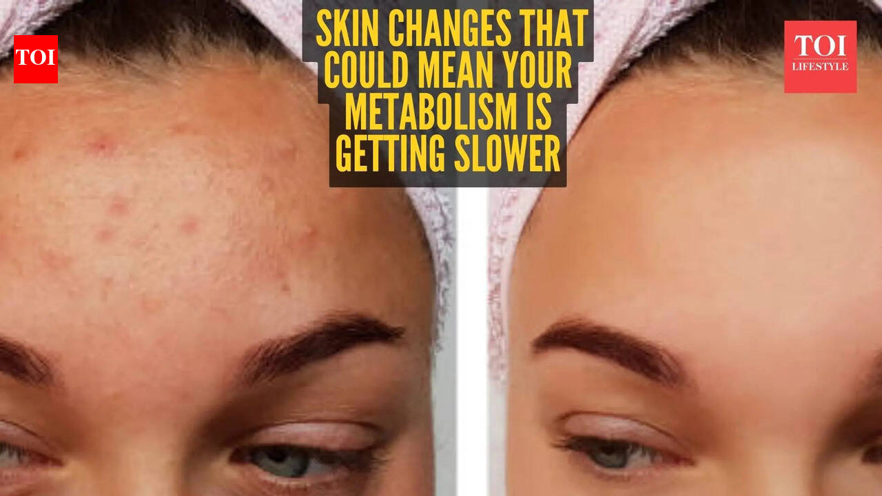 5 skin signs that your Metabolism is slowing down