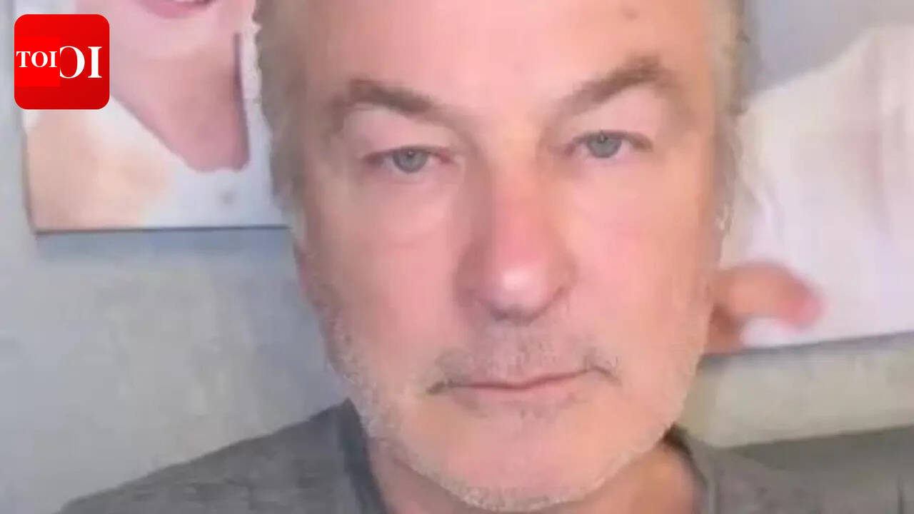 Alec Baldwin's son, Leo split his forehead open during vacation