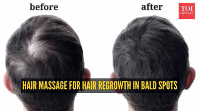 Hair regrowth: How to do the best scalp massage for hair regrowth in bald spots