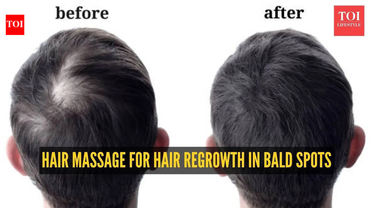 Scalp Massage For Hair Regrowth: Hair regrowth: How to do the best scalp massage for hair regrowth in bald spots – The Times of India