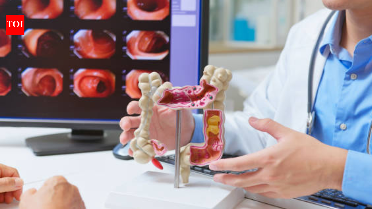 Gardner syndrome: The rare condition that can lead to cancer if undetected