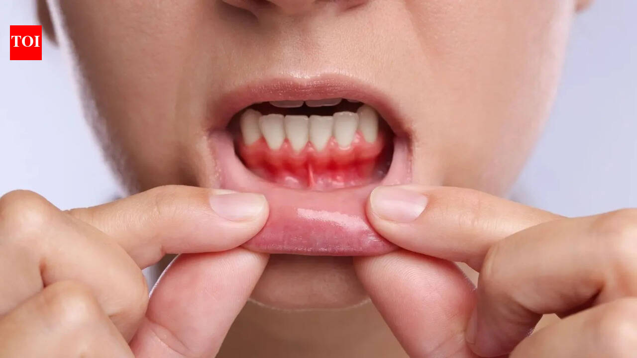 Bleeding gums may signal more than oral disease: How gum health is linked to heart risk and inflammation