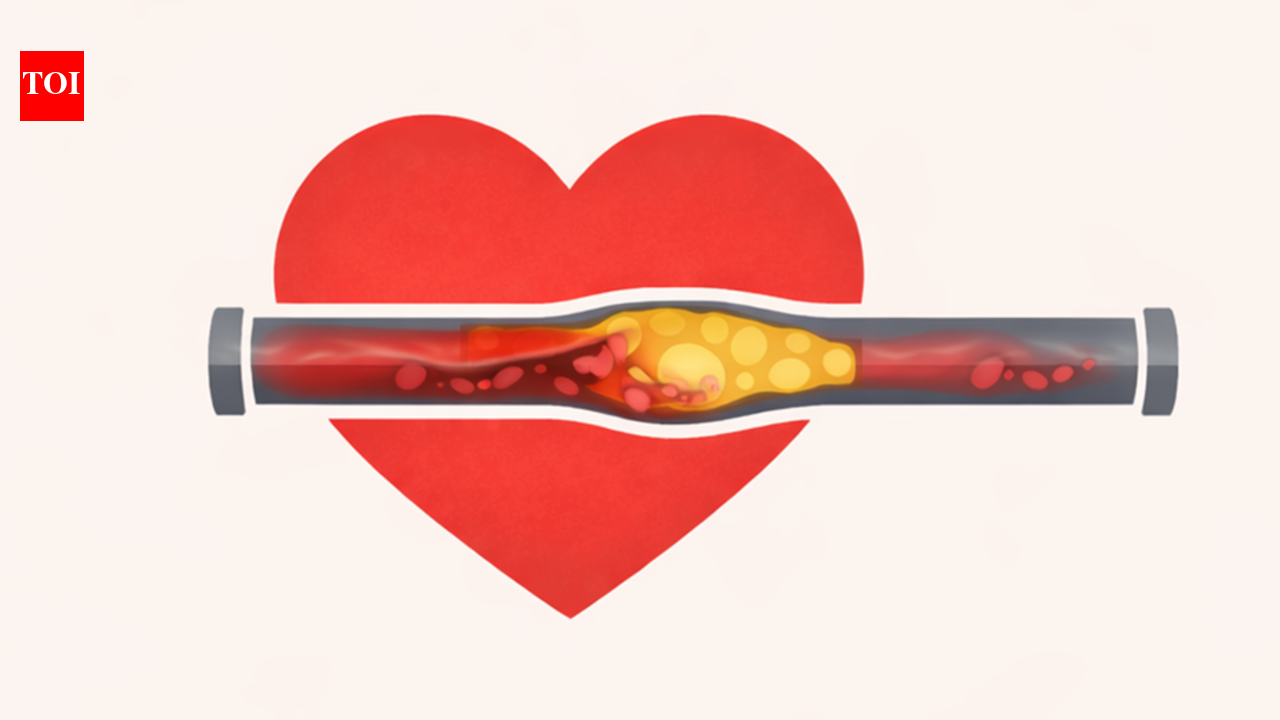 Most heart attacks don’t come out of nowhere. A new tool shows why