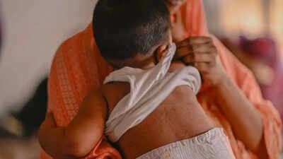 Bangladesh conducts emergency measles vaccinations as outbreak kills more than 100 children