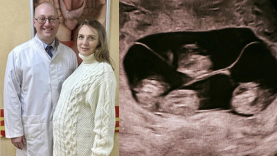 ‘One in 15.5 million’: Woman in Russia gives birth to four identical girls