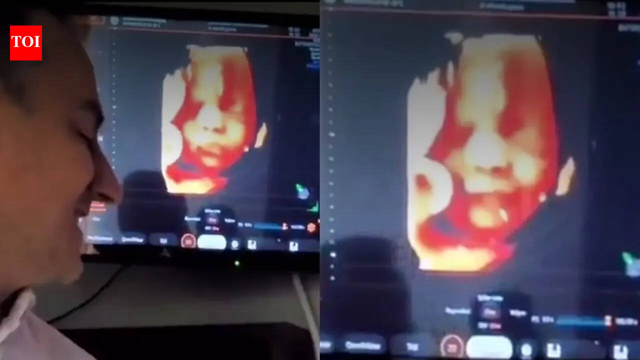 Baby smiles at dad’s voice during 32-week ultrasound; heartwarming video goes viral