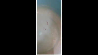 PCMC’s water supply to some areas dirty, has worms: Residents