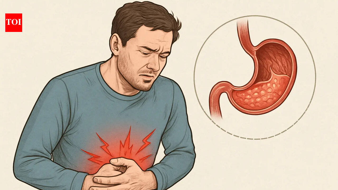 1 in 3 heart patients face gastric issues after stent: Experts