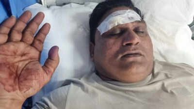 ASI injured in knife attack by burglars during raid in Delhi’s Hari Nagar