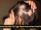 Alopecia Areata: 5 surprising common habits triggering this hair loss condition