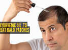 Apply this Ayurvedic oil mix on bald patches and see what happens in 30 days