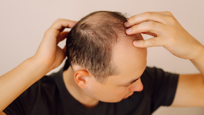 Scientists develop plant-based serum that regrows hair within weeks