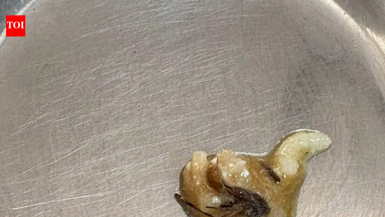 ‘Insects in food’: Protest at Lady Hardinge