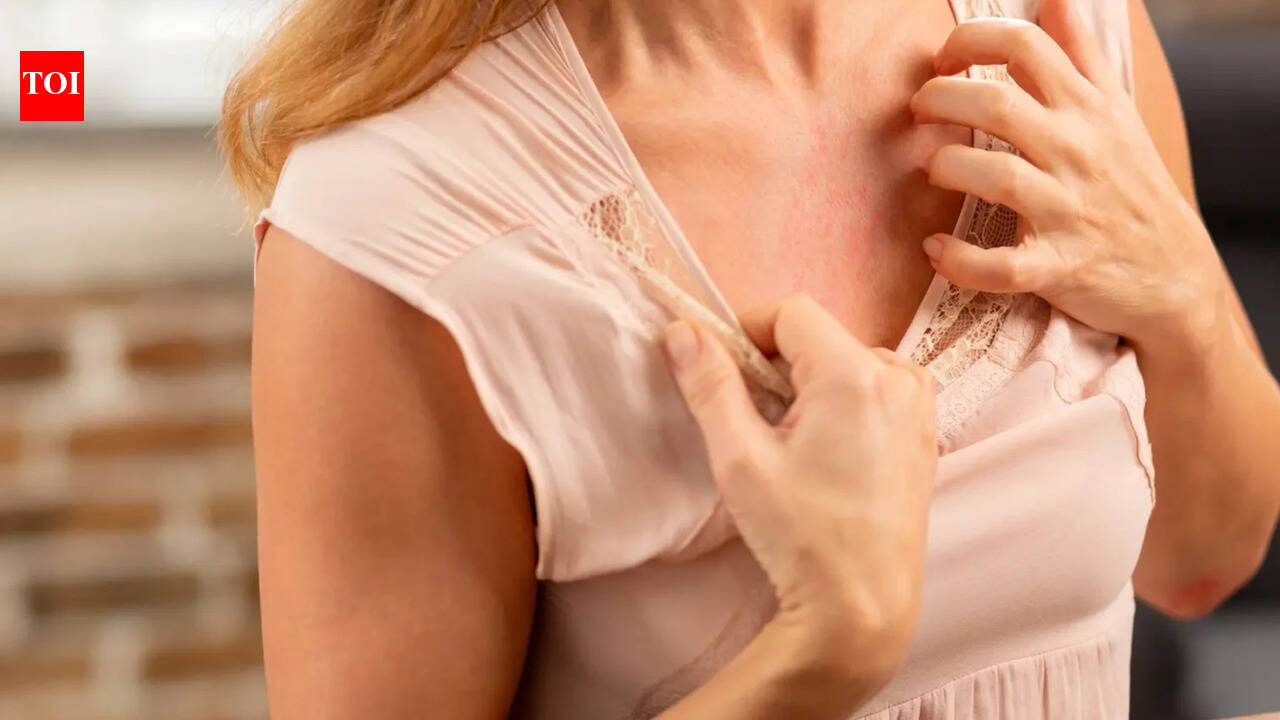 Woman wakes up with mysterious ‘bite marks’ on her chest, netizens urge her to 'go to doctors'