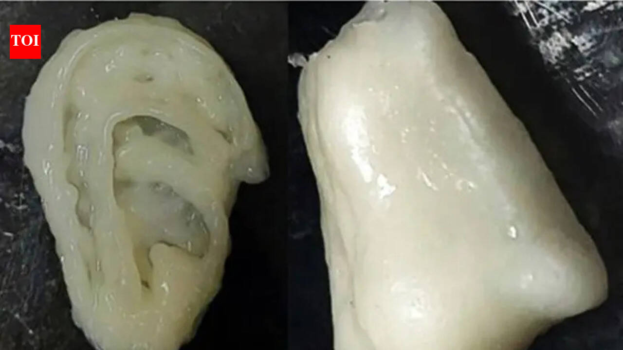 NITR team develops bio-ink to aid 3D bioprinting, tissue engineering