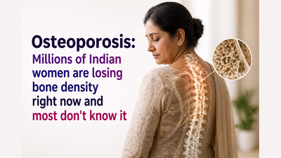 Osteoporosis: Millions of Indian women are losing bone density right now and most don't know it