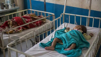 Malnourished 4-month-old girl dies in Madhya Pradesh, twin brother critical