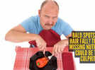 Protein to iron: 5 nutritional deficiencies that can lead to bald spots and hair loss