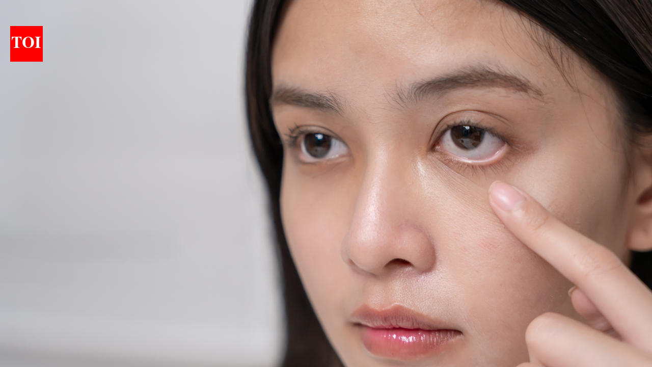 Puffy eyes that won’t go away? Why it could signal kidney trouble, and when to get tested