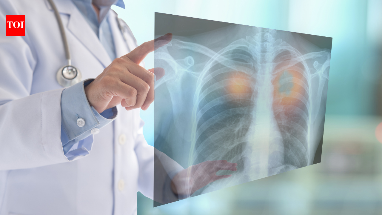 Misdiagnosed as TB, this 28-year-old had lung cancer: The one pill that turned his life around