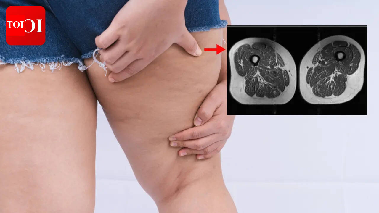 Your junk food is turning your thighs into well-marbled steaks