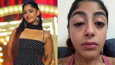 Splitsvilla X6 fame Preet Singh shares traumatic experience after being assaulted at a Mumbai club, says, “I was hit so badly that my tooth broke and my face swelled up