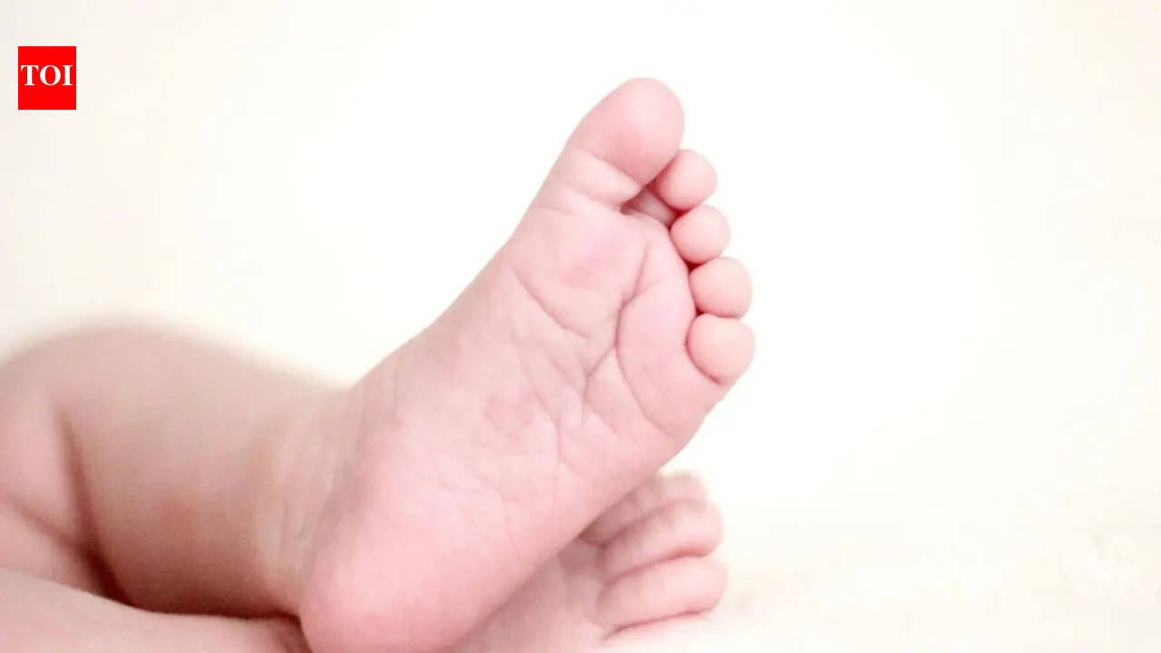 Tanzanian baby with rare skull deformity gets new lease of life in Delhi