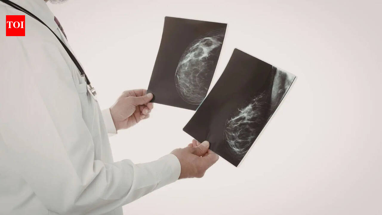 Mammograms are helping docs spot heart disease risk early