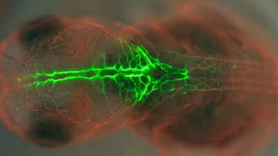 PRICKLE1 protein study uses glowing embryos to understand birth defects