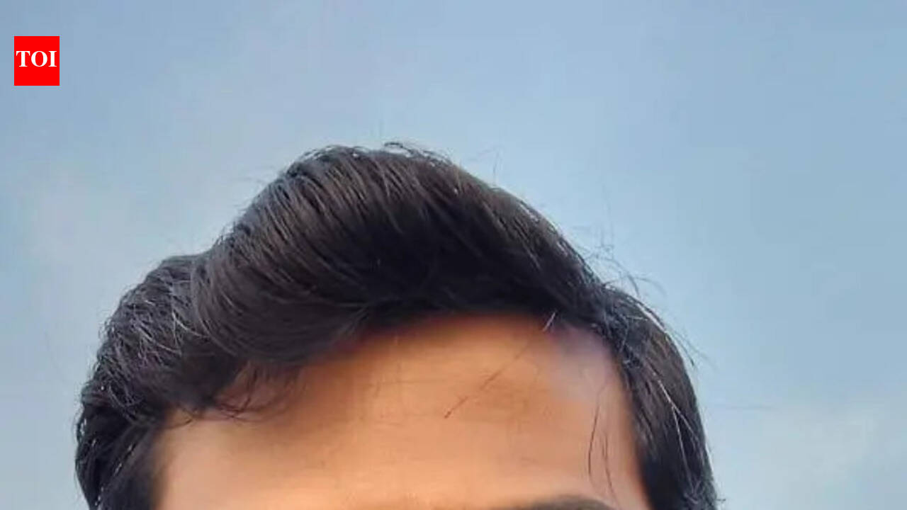 SGPGI performs UP’s first low-cost stem cell transplant for rare genetic disorder