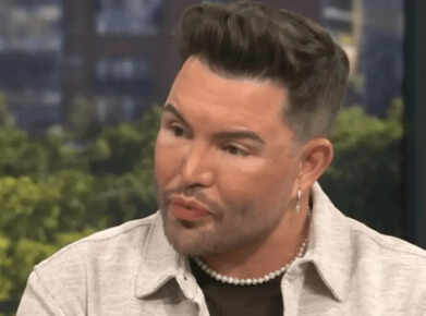 Bobby Norris may undergo more surgery after facelift at 39: &lsquo;I can&rsquo;t say I wouldn&rsquo;t&rsquo;