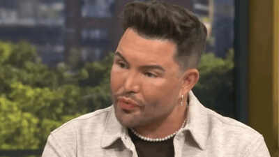 Bobby Norris may undergo more surgery after facelift at 39: 'I can't say I wouldn't'