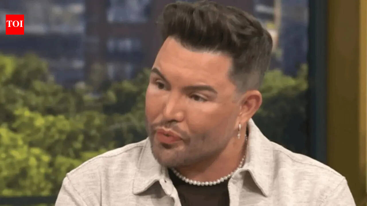Bobby Norris may undergo more surgery after facelift at 39: ‘I can’t say I wouldn’t’