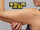 Loose skin after weight loss: What causes it and what you can do?