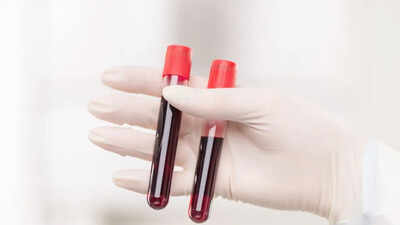 World's rarest hybrid blood type discovered in Thailand: Study found in just 3 people out of a massive research of 544,000 samples